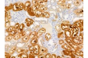 ABIN6266223 and ABIN6277374 at 1/100 staining human normal kidney tissue by IHC-P. (Gelsolin Antikörper  (C-Term))