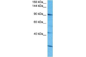 Host:  Rabbit  Target Name:  SALL4  Sample Tissue:  Human 721_B Whole Cell  Antibody Dilution:  1ug/ml (SALL4 Antikörper  (N-Term))