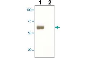 The whole cell lysate derived from LNCaP was immunoblotted by SOX9 polyclonal antibody  at 1 : 500 (Lane 1), Lane 2 is a negative control.