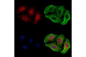 ABIN6255667 and ABIN6267591 staining Hela cells(4h of LPS treatment) by IF/ICC.