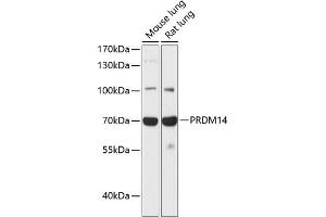 Western blot analysis of extracts of various cell lines, using PRDM14 antibody (ABIN6128495, ABIN6146132, ABIN6146135 and ABIN6217736) at 1:1000 dilution. (PRDM14 Antikörper  (AA 1-260))