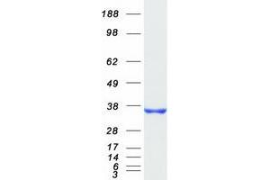 Validation with Western Blot (CYB5R3 Protein (Transcript Variant 1) (Myc-DYKDDDDK Tag))