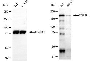 Western blotting analysis using TOP2A antibody (ABIN7800573). (Topoisomerase II alpha Antikörper)