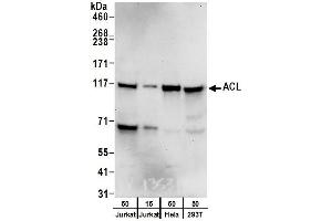 Western Blotting (WB) image for anti-ATP Citrate Lyase (ACLY) (AA 1051-1101) antibody (ABIN7452922)