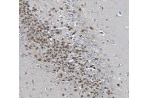 IHC analysis of Rad9b using anti-Rad9b antibody (ABIN7599360). (RAD9B Antikörper  (AA 1-403))