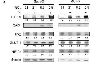 Bortezomib attenuates HIF-1 but not HIF-2 transcriptional activity. (EPAS1 Antikörper)
