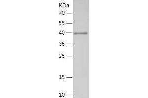 Western Blotting (WB) image for Chromosome 15 Open Reading Frame 53 (C15ORF53) (AA 1-179) protein (His-IF2DI Tag) (ABIN7122380) (C15ORF53 Protein (AA 1-179) (His-IF2DI Tag))