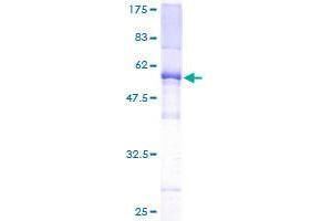 Image no. 1 for TAF9B RNA Polymerase II, TATA Box Binding Protein (TBP)-Associated Factor, 31kDa (TAF9B) (AA 1-251) protein (GST tag) (ABIN1322117) (TAF9B Protein (AA 1-251) (GST tag))