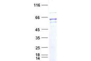 Western Blotting (WB) image for Thyroid Hormone Receptor, alpha (THRA) protein (DYKDDDDK Tag) (ABIN2733596)