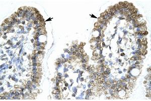 Rabbit Anti-MYCBP Antibody Catalog Number: ARP31860 Paraffin Embedded Tissue: Human Intestine Cellular Data: Epithelial cells of intestinal villas Antibody Concentration: 4. (MYCBP Antikörper  (Middle Region))