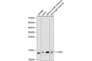 Western blot analysis of extracts of various cell lines using S100P Polyclonal Antibody at dilution of 1:1000.
