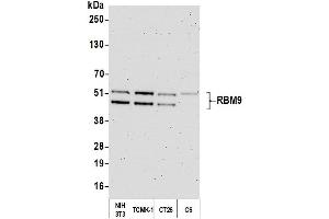 Western Blotting (WB) image for anti-RNA Binding Motif Protein 9 (RBM9) (AA 1-50) antibody (ABIN7454680)