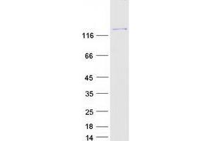 Western Blotting (WB) image for phospholipase C, gamma 1 (PLCG1) (Transcript Variant 1) protein (Myc-DYKDDDDK Tag) (ABIN2729134)