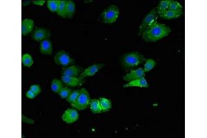 Immunofluorescent analysis of HepG2 cells using ABIN7151564 at dilution of 1:100 and Alexa Fluor 488-congugated AffiniPure Goat Anti-Rabbit IgG(H+L) (ELOVL4 Antikörper  (AA 270-314))