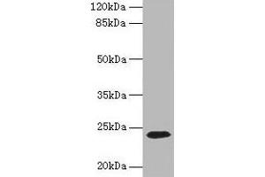 Western blot All lanes: CD3E antibody at 1. (CD3 epsilon Antikörper  (AA 23-207))