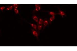 ABIN6277528 staining 293 by IF/ICC. (Ephrin A1 Antikörper  (Internal Region))