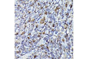 Immunohistochemistry of paraffin-embedded human tonsil using Smad2 Rabbit pAb (ABIN1513537, ABIN3020986, ABIN3020987 and ABIN1514681) at dilution of 1:100 (40x lens). (SMAD2 Antikörper)