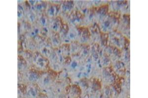 IHC-P analysis of Liver tissue, with DAB staining. (CD40 Ligand Antikörper  (AA 180-261))