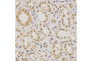 Immunohistochemistry (IHC) image for anti-Pyruvate Dehydrogenase (Lipoamide) alpha 1 (PDHA1) (AA 30-390) antibody (ABIN3023697)