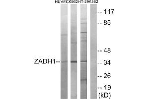 Western blot analysis of extracts from HUVEC cells, K562 cells and HT-29 cells, using ZADH1 antibody. (PTGR2 Antikörper  (Internal Region))