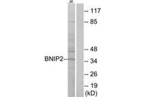 Western blot analysis of extracts from Jurkat cells, using BNIP2 Antibody.