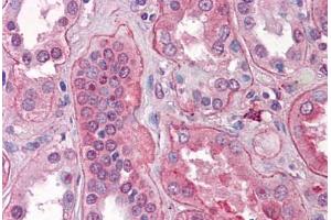 Immunohistochemistry (Formalin-fixed Paraffin-embedded Sections) (IHC (fp)) image for anti-Fibroblast Growth Factor Receptor 1 (FGFR1) (N-Term) antibody (ABIN790675)