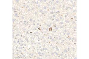 Immunohistochemistry of paraffin embedded mouse liver using RAB21 (ABIN7075341) at dilution of 1: 700 (300x lens) (RAB21 Antikörper)