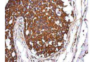 Immunohistochemistry (IHC) image for anti-Achalasia, Adrenocortical Insufficiency, Alacrimia (AAAS) (Internal Region) antibody (ABIN2854764)
