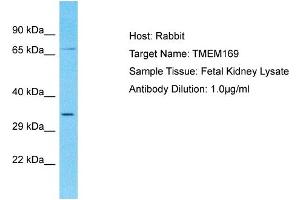 Host: Rabbit Target Name: TMEM169 Sample Type: Fetal Kidney lysates Antibody Dilution: 1. (TMEM169 Antikörper  (C-Term))