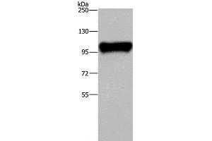 Western Blot analysis of Raji cell using PTK2B Polyclonal Antibody at dilution of 1:300 (PTK2B Antikörper)