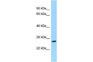 Host: Rabbit Target Name: CCDC28B Sample Type: Hela Whole cell lysates Antibody Dilution: 1.