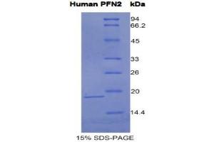 SDS-PAGE analysis of Human Profilin 2 Protein.