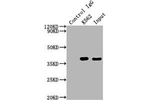Immunoprecipitating CDK6 in K562 whole cell lysate Lane 1: Rabbit control IgG instead of ABIN7127420 in K562 whole cell lysate. (Rekombinanter CDK6 Antikörper)
