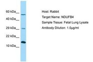 Image no. 1 for anti-NADH Dehydrogenase (Ubiquinone) 1 beta Subcomplex, 4, 15kDa (NDUFB4) (AA 71-120) antibody (ABIN6750060) (NDUFB4 Antikörper  (AA 71-120))
