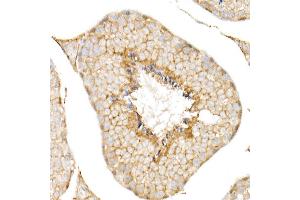 Immunohistochemistry of paraffin-embedded human liver using CD81 Rabbit pAb (ABIN6134776, ABIN6138231, ABIN6138232 and ABIN6220897) at dilution of 1:50 (40x lens). (CD81 Antikörper  (AA 1-100))