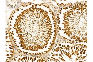 ABIN6261249 and ABIN6268912 at 1/100 staining Rat testis tissue by IHC-P. (DDR1 Antikörper  (C-Term))