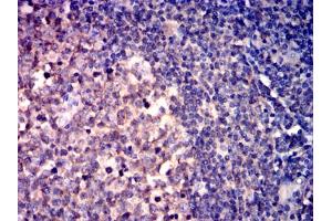 Immunohistochemical analysis of paraffin-embedded lymphoid tissues using CD267 mouse mAb with DAB staining. (TACI Antikörper)