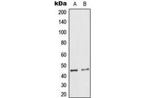 Western blot analysis of Cytokeratin 18 (pS33) expression in A431 (A), HeLa (B) whole cell lysates. (Cytokeratin 18 Antikörper  (N-Term, pSer33))
