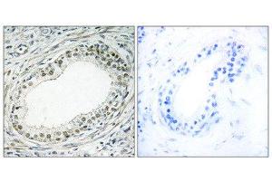 Immunohistochemistry (IHC) image for anti-Ribosomal Protein L36 (RPL36) (Internal Region) antibody (ABIN1850636) (RPL36 Antikörper  (Internal Region))