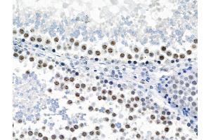 Phospho-JIP1 (Thr205) Antibody at 1/100 staining Rat testis tissue by IHC-P. (MAPK8IP1 Antikörper  (pThr205))