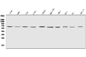 Western blot analysis of IL2 Receptor gamma/IL2RG using anti-IL2 Receptor gamma/IL2RG antibody (ABIN7603175).