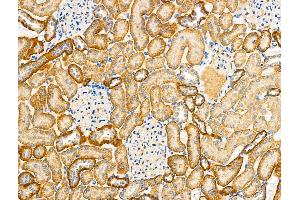 ABIN6260880 and ABIN6279304 at 1/100 staining Rat kidney tissue by IHC-P. (CLDN14 Antikörper  (C-Term))