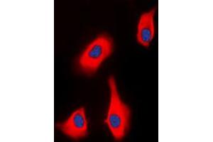 Immunofluorescent analysis of PTHR1 staining in HEK293T cells. (PTH1R Antikörper  (Center))