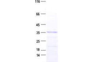 Validation with Western Blot (ZNF32 Protein (His tag))