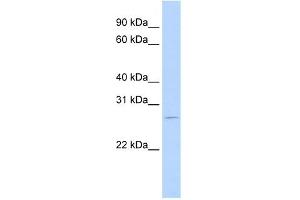 WB Suggested Anti-RBM38 Antibody Titration:  0. (RBM38 Antikörper  (N-Term))