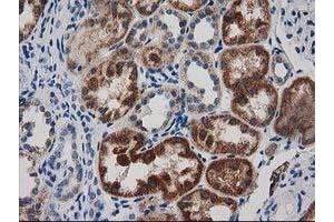 Immunohistochemical staining of paraffin-embedded Human Kidney tissue using anti-GRHPR mouse monoclonal antibody. (GRHPR Antikörper)