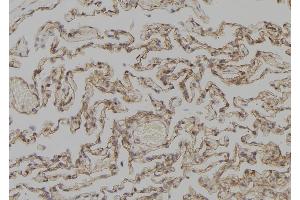 ABIN6277309 at 1/100 staining Human lung tissue by IHC-P. (KRT4 Antikörper)