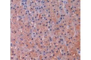 Immunohistochemistry (IHC) image for anti-Microtubule Associated Tumor Suppressor 1 (MTUS1) (AA 1-196) antibody (ABIN5013948)