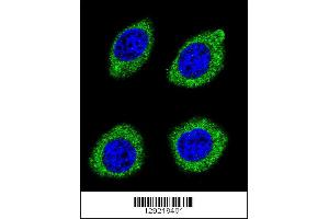 Confocal immunofluorescent analysis of HSD11B1L Antibody with U-251MG cell followed by Alexa Fluor 488-conjugated goat anti-rabbit lgG (green). (HSD11B1L Antikörper  (C-Term))