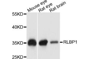 Western blot analysis of extract of various cells, using RLBP1 antibody. (RLBP1 Antikörper)